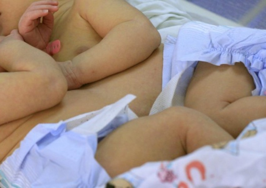 14-годишна роди сиамски близнаци с общ таз