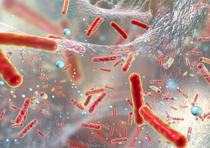 Месоядна бактерия изяде 25 % от кожата на мъж