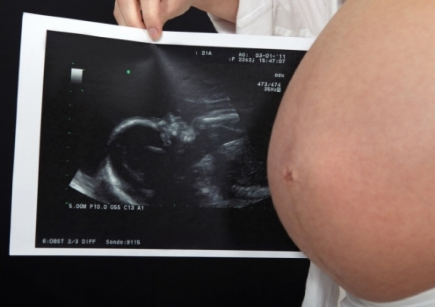 Българка почина при раждане на близначки в Канада