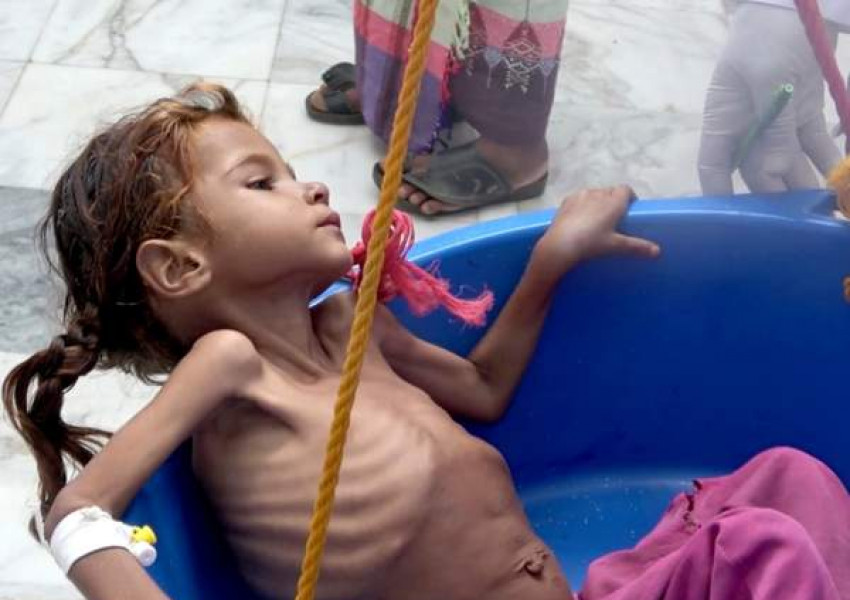 Хранителните запаси на Йемен свършват след два месеца