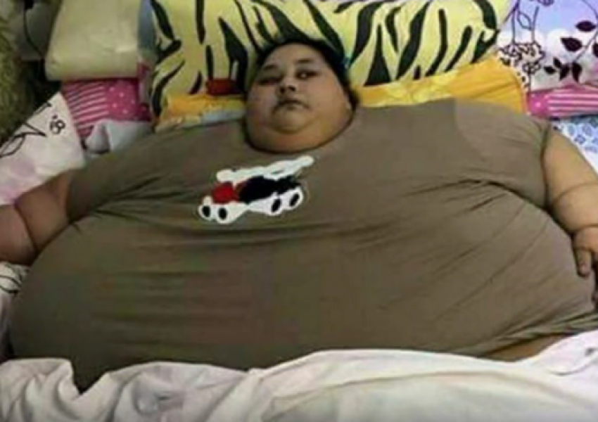 Най-дебелата жена в света отслабнала със 140 кг 