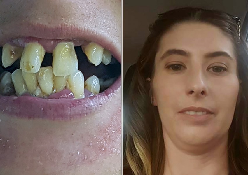 Оправиха зъбите на тази жена безплатно. Но защо? (СНИМКИ 18+)
