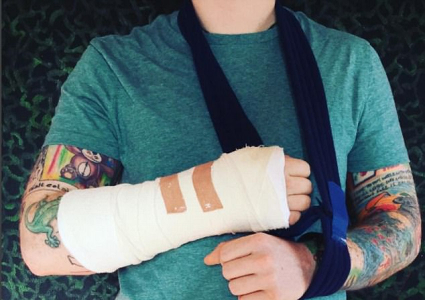 Ед Шийран отменя турне заради счупената си ръка