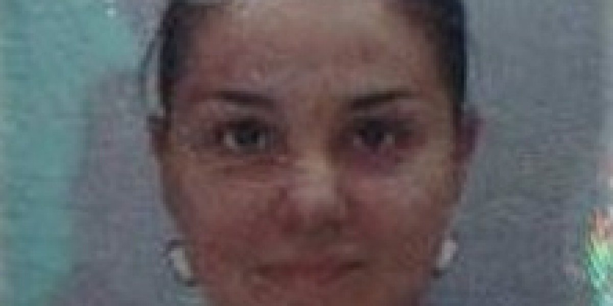 Заляха българка с киселина в Индия (СНИМКИ 18+)