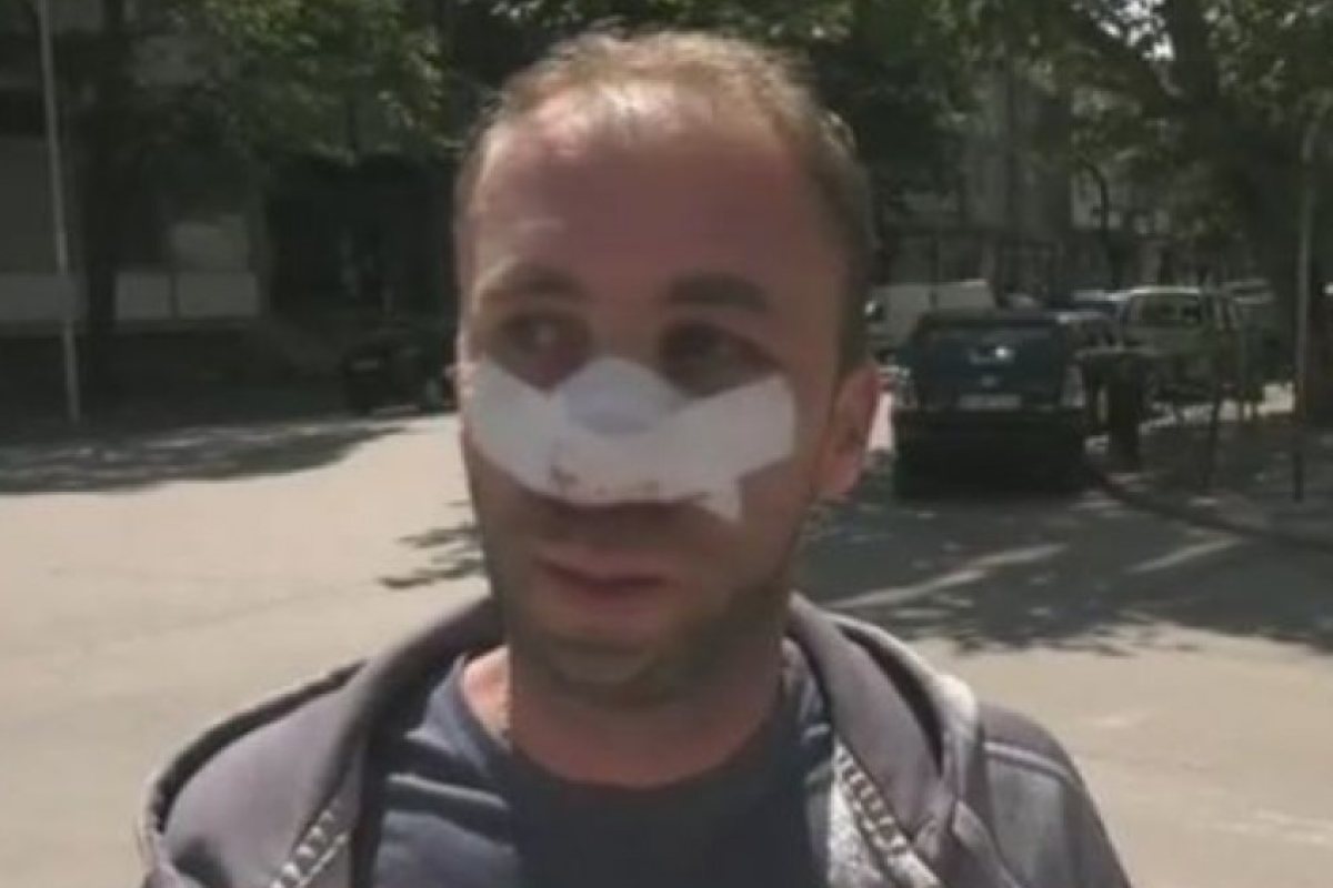 Таксиметров шофьор преби мъж