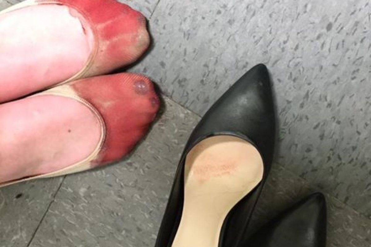 Ето как изглеждат краката на една сервитьорка в Англия (СНИМКИ 18+)