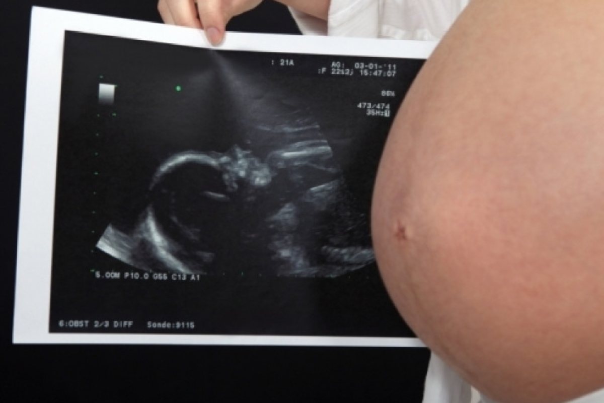 Българка почина при раждане на близначки в Канада