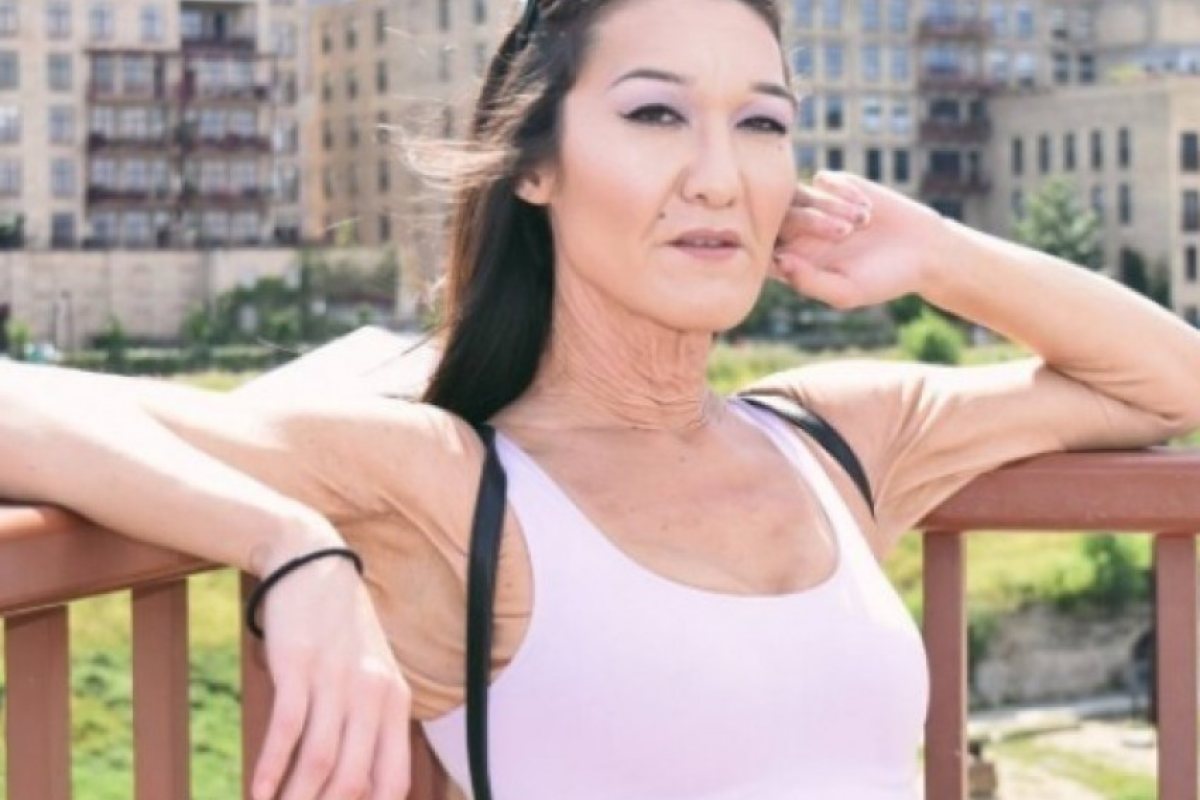 Тя е на 26 години, но прилича на 60! Защо?
