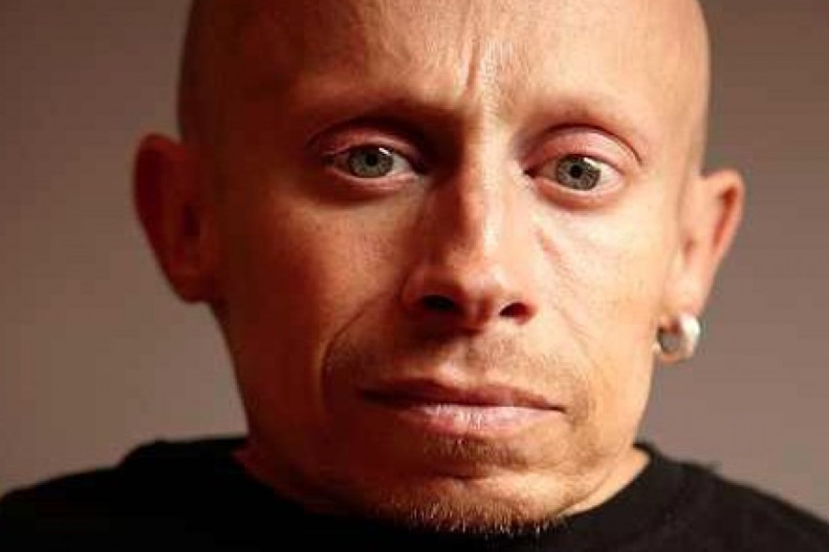 Мини Ми от "Остин Пауърс" се е самоубил с алкохол