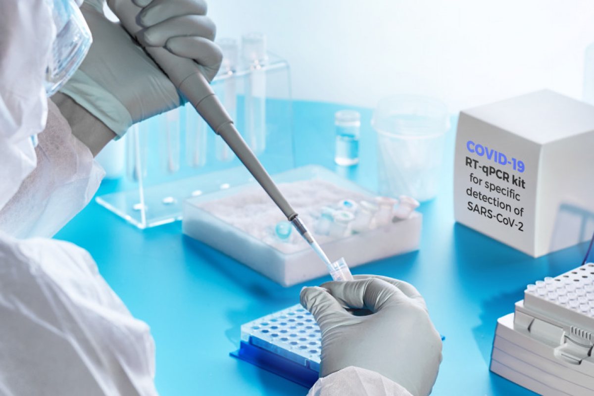 Колко всъщност струва PCR-тестът? Цената, за която никой не говори.