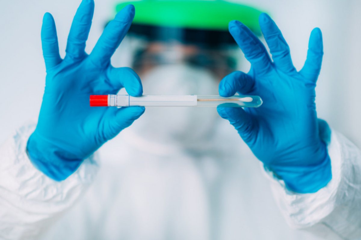 Вече и в България PCR теста е безплатен!