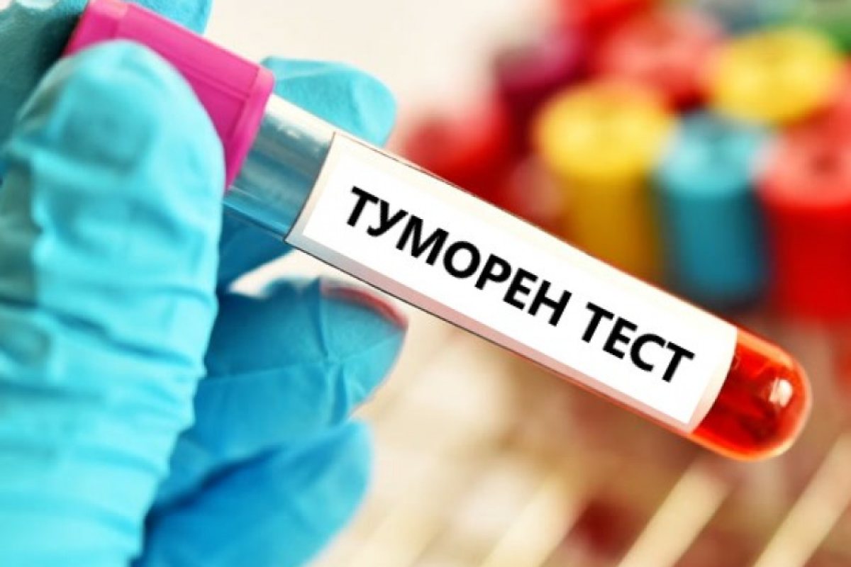 Великобритания: Тест ще засича 50 ракови заболявания преди проявата на симптомите им!