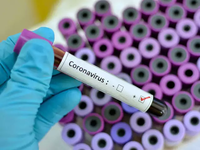 Още една британка почина заради коронавируса