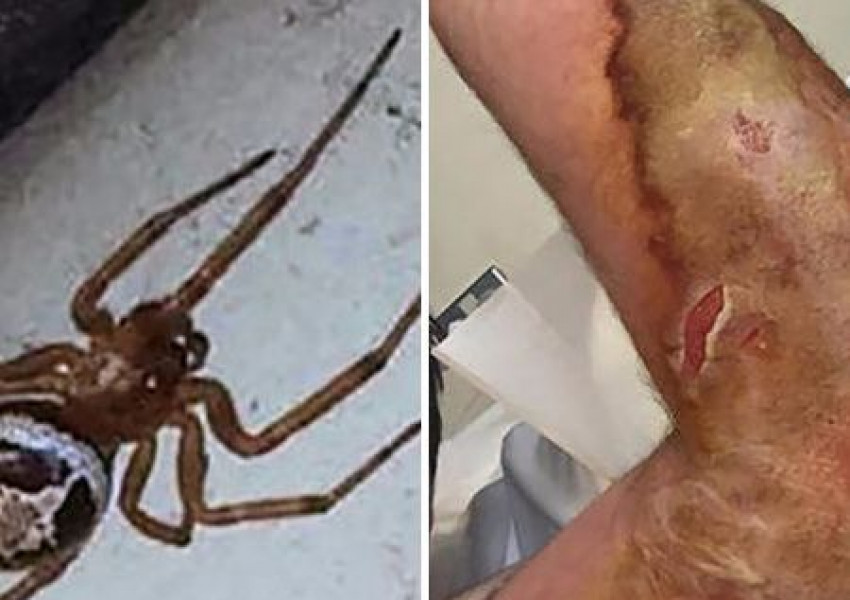 Опасни паяци плъзнаха из домовете на Острова (СНИМКИ)