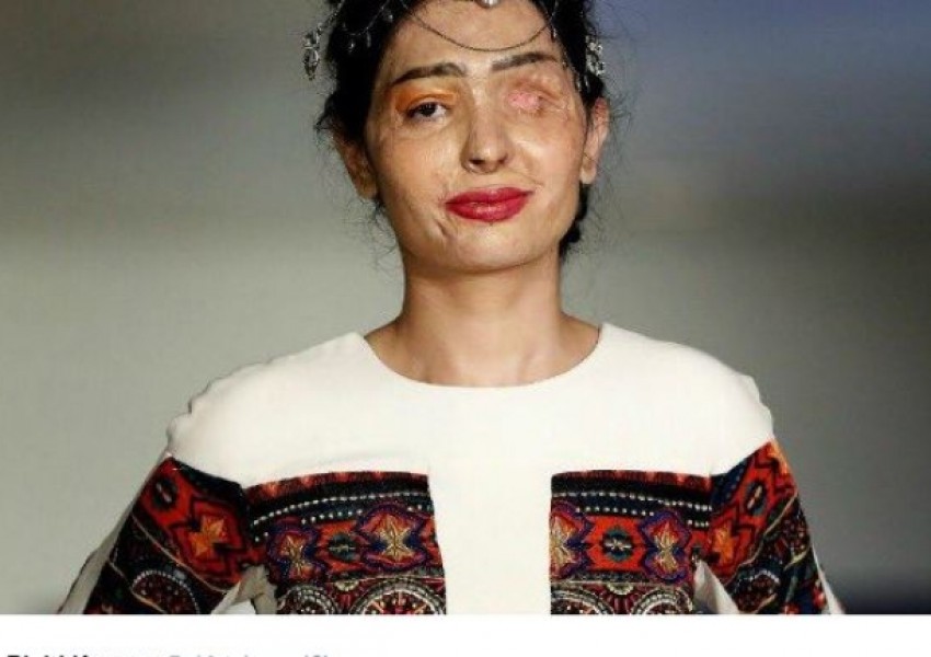 Индийка, залята с киселина, откри седмицата на модата в Ню Йорк
