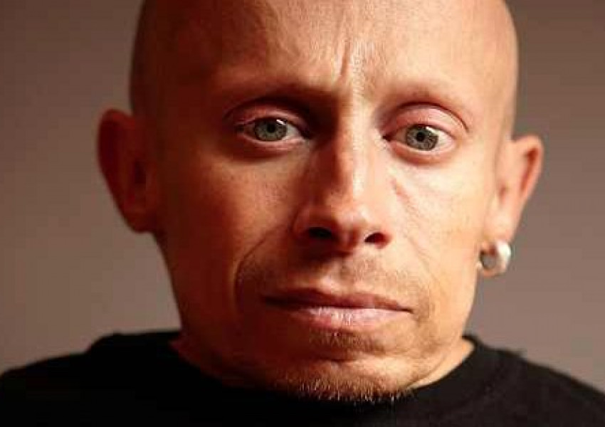 Мини Ми от "Остин Пауърс" се е самоубил с алкохол