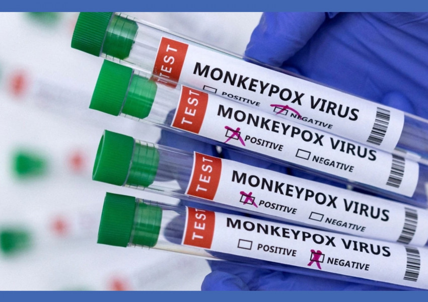 Европа купува 110 000 ваксини за маймунска шарка, 900 са заболелите европейци до момента от нея