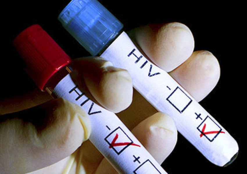 Къде можем да се изследваме безплатно за ХИВ/СПИН?
