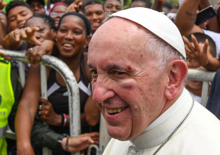 Папа Франциск пострада при инцидент на пътя