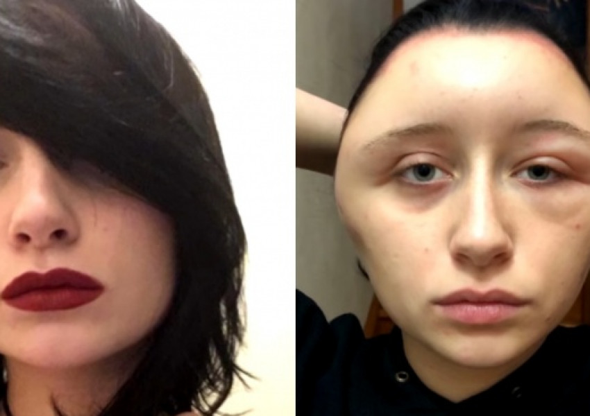 Французойка едва не умря заради боя за коса (ВИДЕО)