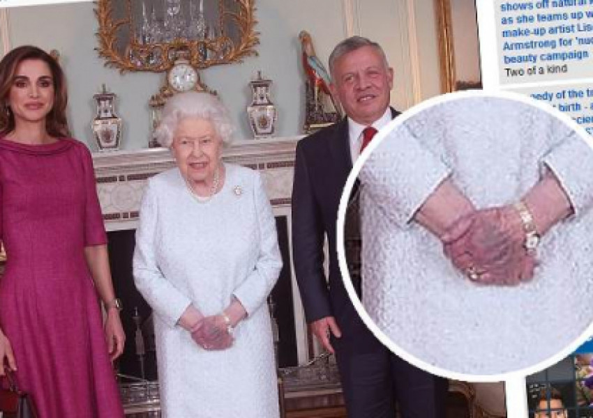 Странен хематом на ръката на Кралицата шокира британците