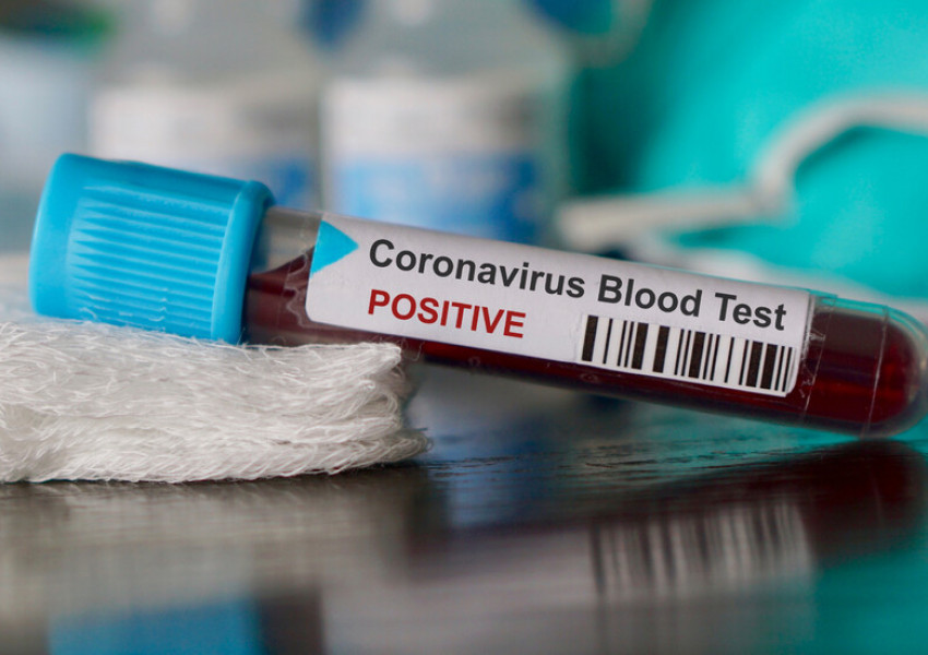 Излезе пробата за коронавирус на украинския гражданин