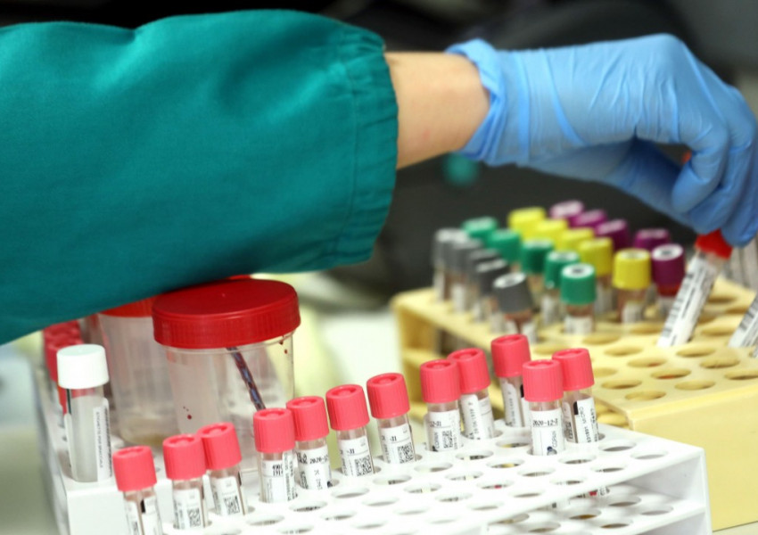 В Англия започват клинични тестове на лекарства срещу коронавирус