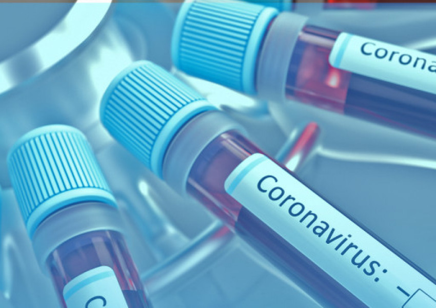 169 нови случая на коронавирус у нас