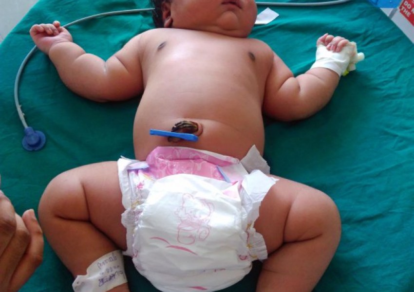 19-годишна индийка роди най-тежкото бебе на света