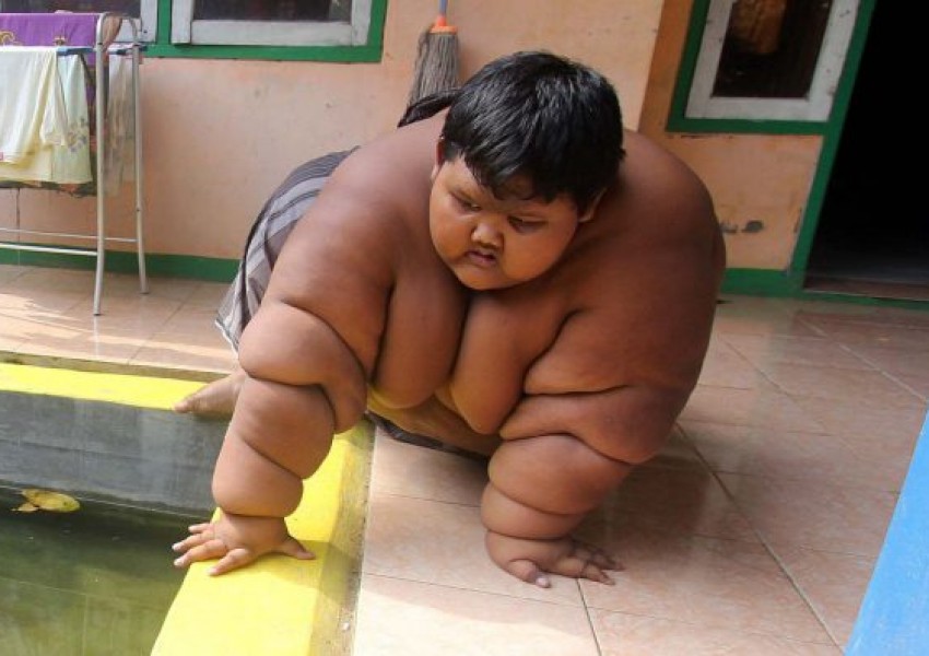 Това е най-дебелото дете в света (СНИМКИ)
