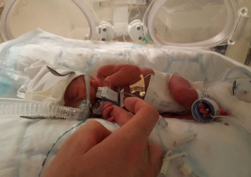 Бебе, родено 700 грама, е най-малкото във Великобритания