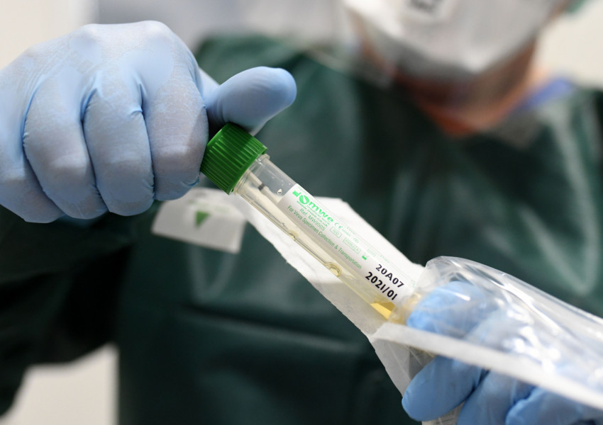 Учени започват изпитание на експериментална ваксина