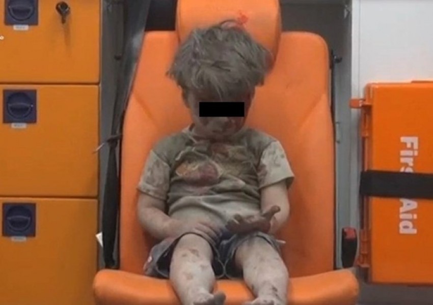 Шокиращи снимки на малко дете показват ужаса в Сирия