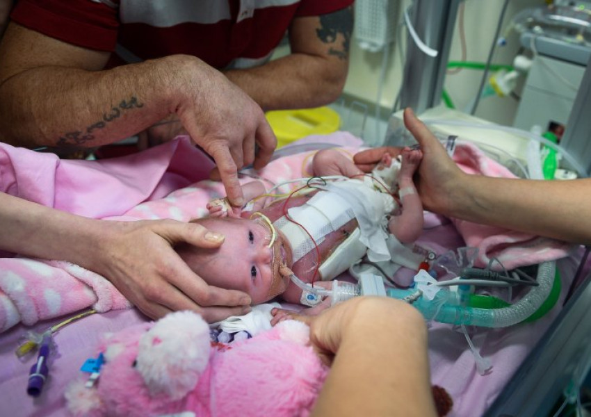 Бебенце със сърце извън тялото се роди във Великобритания