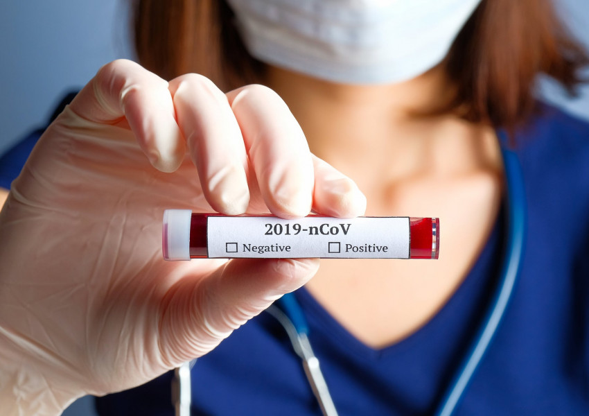 СДС- Дупница стартира безплатни тестове за коронавирус 