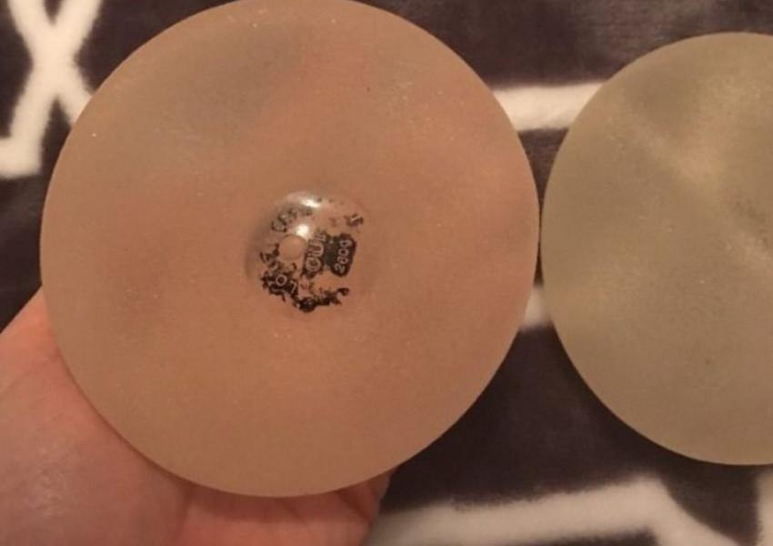 Жена си продава имплантите по Ebay