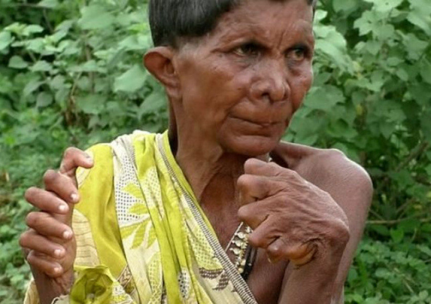 Обявиха индийка с 31 пръста за вещица