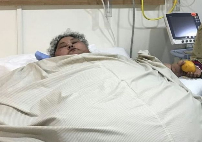 Оперираха успешно жена, тежаща 500 килограма