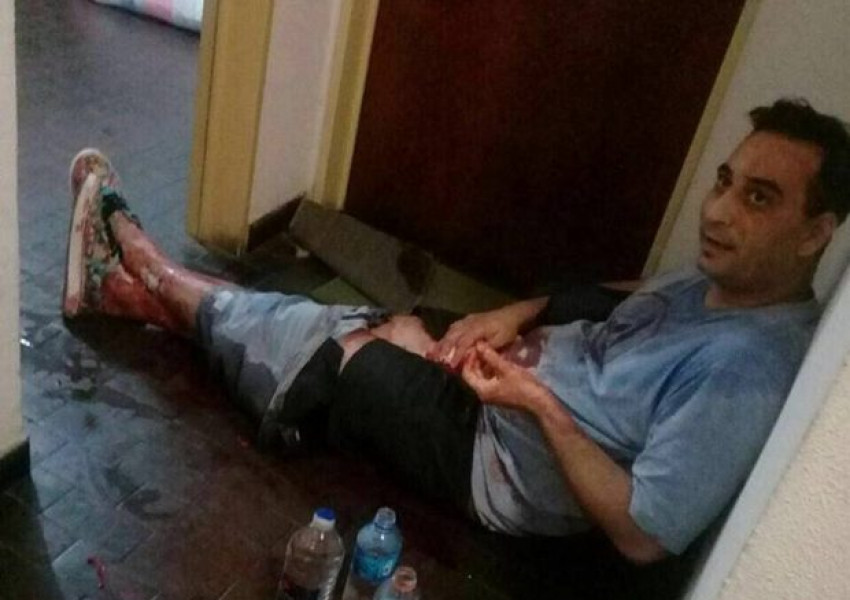 Жена отряза пениса на мъжа си (СНИМКА 18 +)