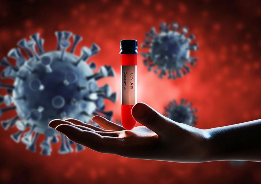 36 нови случая на коронавирус у нас, още 3 души са починали