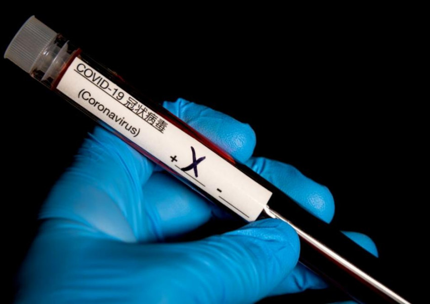 Заразените с новия коронавирус надхвърлиха 100 000 души