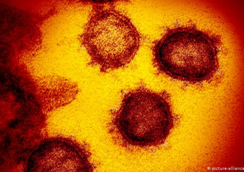 САЩ е страната с най-много заразени с коронавирус в света