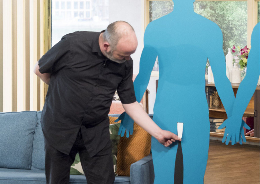 Мъжът с най-малкия пенис във Великобритания разказва своята история