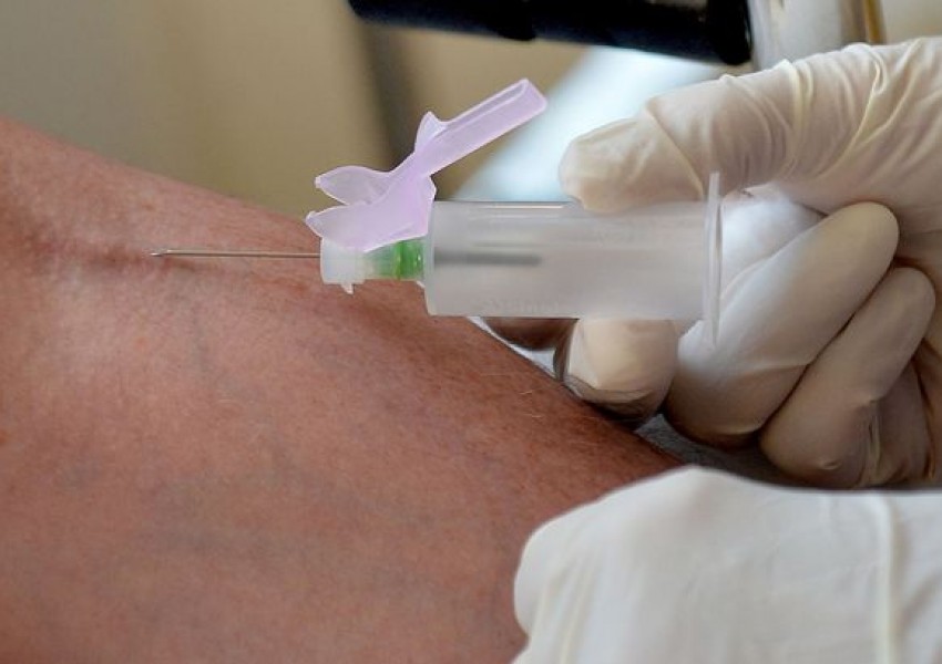 Британски учени разработиха ДНК тест за рак на кожата, който може да спаси милиони