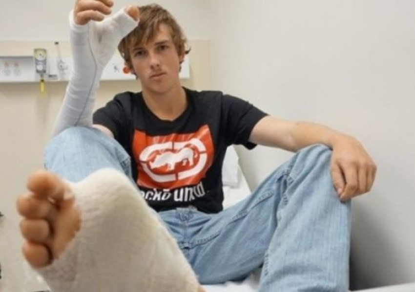 Присадиха на ръката на младеж пръст от крака му  