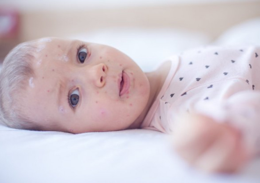 Бум на дребна шарка! Внимавайте, ако пътувате за Румъния!