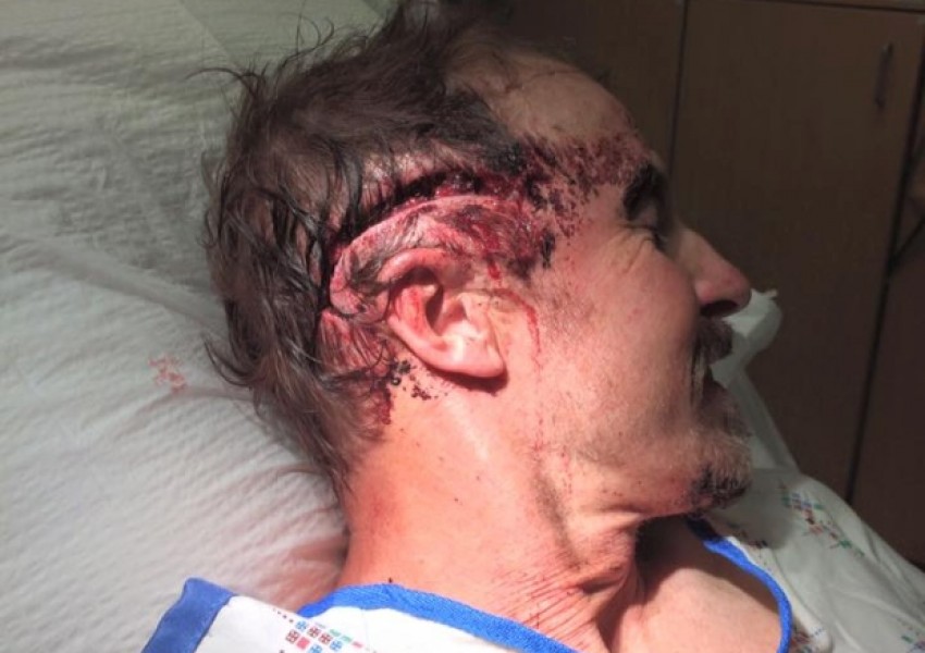Гризли нападна човек в Монтана (ВИДЕО)