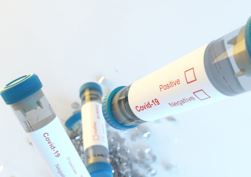 Италия започва тестове на ваксина срещу КОВИД 19